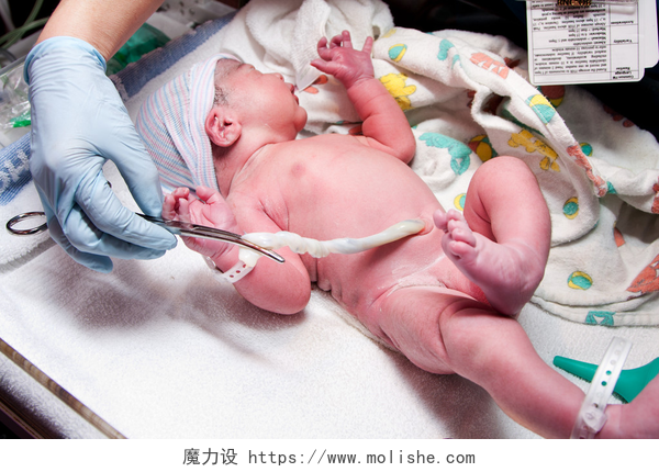 医生在育婴室给新生儿剪脐带可爱婴儿新生儿的脐带